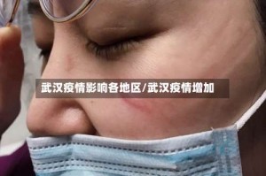 武汉疫情影响各地区/武汉疫情增加