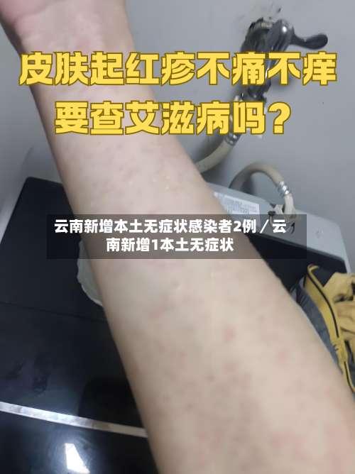 云南新增本土无症状感染者2例／云南新增1本土无症状-第1张图片