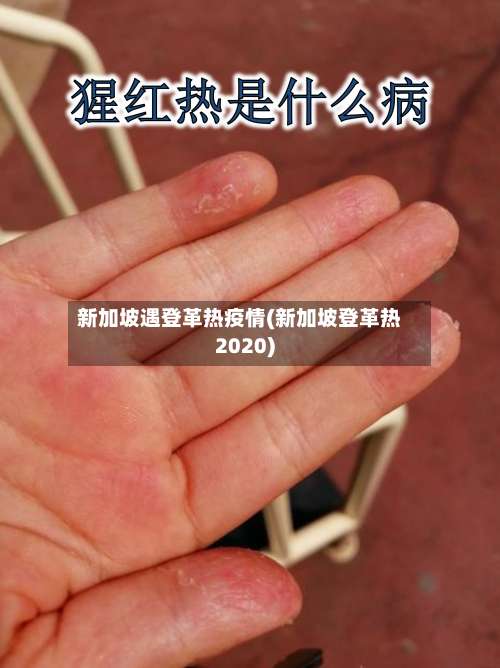 新加坡遇登革热疫情(新加坡登革热2020)-第2张图片