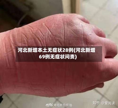 河北新增本土无症状28例(河北新增69例无症状问责)-第2张图片
