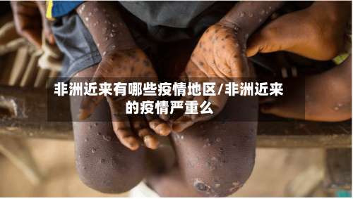 非洲近来有哪些疫情地区/非洲近来的疫情严重么-第2张图片