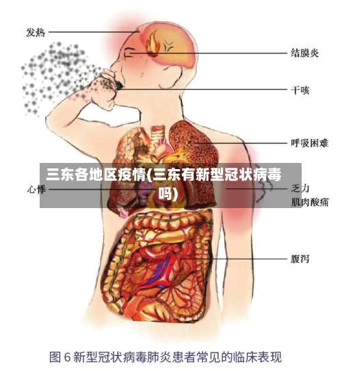 三东各地区疫情(三东有新型冠状病毒吗)-第2张图片