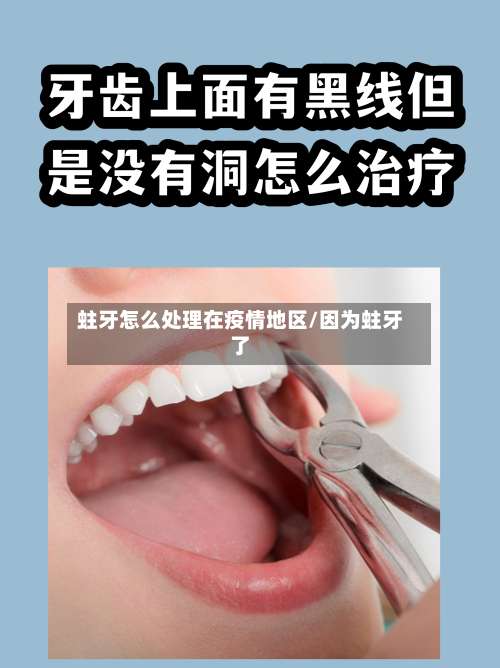 蛀牙怎么处理在疫情地区/因为蛀牙了-第2张图片