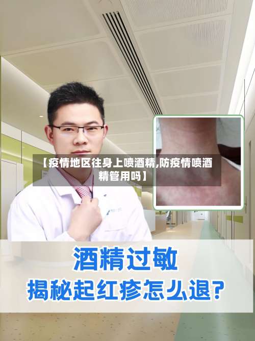 【疫情地区往身上喷酒精,防疫情喷酒精管用吗】-第1张图片